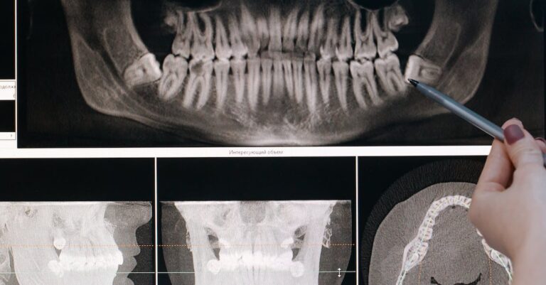 Having A Brighter Smile Through Teeth Whitening